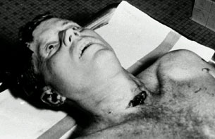 Kennedy muerto