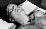Kennedy muerto